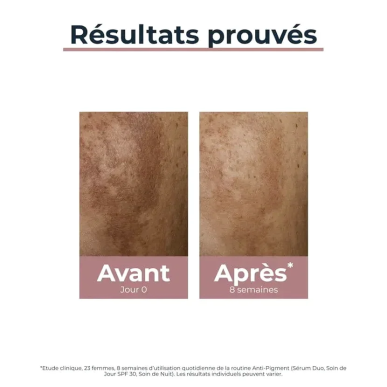 EUCERIN Serum Duo Anti Pigment 30ml – soins anti-taches et dépigmentants | EUCERIN - Visage Tunisie | Miral Parapharmacie