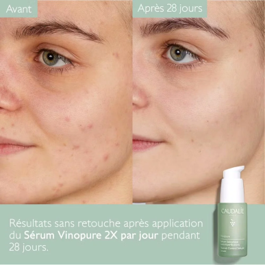 Caudalie Vinopure Sérum Salicylique Anti-Imperfections 30ml – Soins peau grasse, mixte et acné / Peaux à imperfections | Caudali