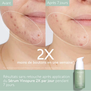 Caudalie Vinopure Sérum Salicylique Anti-Imperfections 30ml – Soins peau grasse, mixte et acné / Peaux à imperfections | Caudali