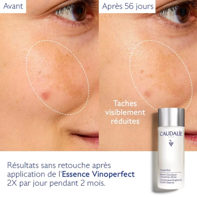 Caudalie Vinoperfect Essence Glycolique Concentrée d’Éclat 100ml – soins anti-taches et dépigmentants | Caudalie - Visage Tunisi