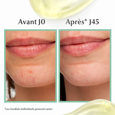 Eucerin DermoPure Sérum Triple Action 40ml – Soins peau grasse, mixte et acné | DermoPure - Visage Tunisie | Miral Parapharmacie