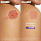 A-DERMA Epitheliale A.H Ultra Repair Crème Réparatrice Anti-Marques 40ml