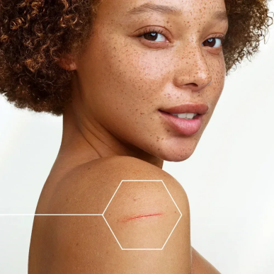 A-DERMA Epitheliale A.H Ultra Repair Crème Réparatrice Anti-Marques 40ml – soins des cicatrices | ADERMA - Visage Tunisie | Mira